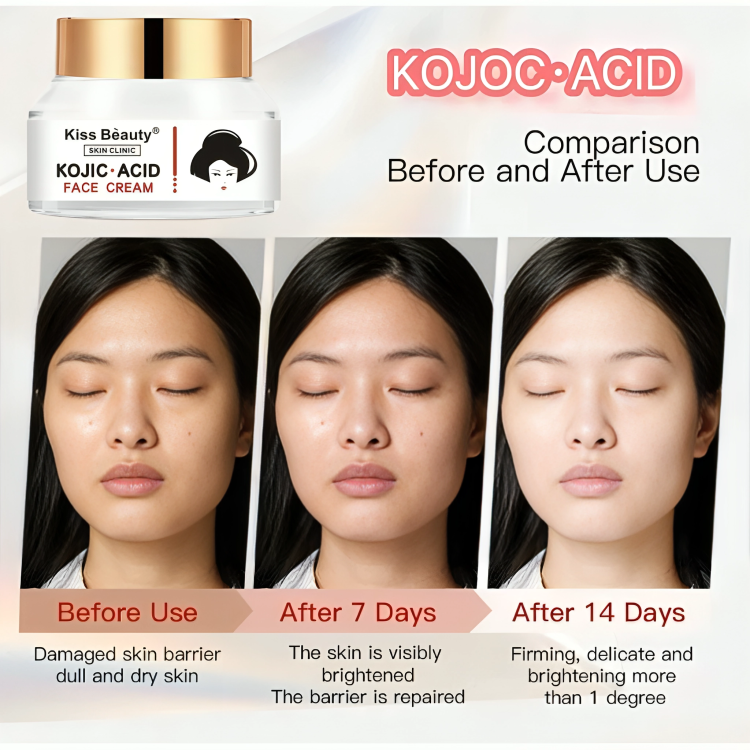 كريم كوجيك أسيد لتفتيح الوجه